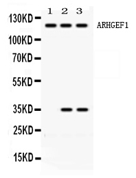 ARHGEF1 Antibody - Western blot - Anti-ARHGEF1/Lsc Picoband Antibody