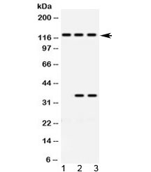 ARHGEF1 Antibody - Western blot testing of 1) rat brain, 2) human HeLa and 3) human Jurkat lysate with ARHGEF1 antibody at 0.5ug/ml. Predicted molecular weight ~102 kDa, but routinely observed at ~115 kDa.