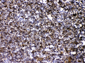 ARHGEF1 Antibody - IHC testing of FFPE mouse lymph tissue with ARHGEF1 antibody at 1ug/ml. HIER: steam sections in pH6 citrate buffer for 20 min.
