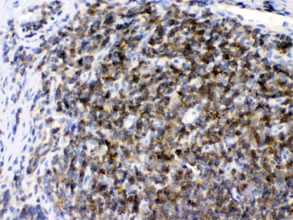 ARHGEF1 Antibody - IHC testing of FFPE rat lymph tissue with ARHGEF1 antibody at 1ug/ml. HIER: steam sections in pH6 citrate buffer for 20 min.