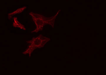 ARHGEF1 Antibody - Staining COLO205 cells by IF/ICC. The samples were fixed with PFA and permeabilized in 0.1% Triton X-100, then blocked in 10% serum for 45 min at 25°C. The primary antibody was diluted at 1:200 and incubated with the sample for 1 hour at 37°C. An Alexa Fluor 594 conjugated goat anti-rabbit IgG (H+L) antibody, diluted at 1/600, was used as secondary antibody.