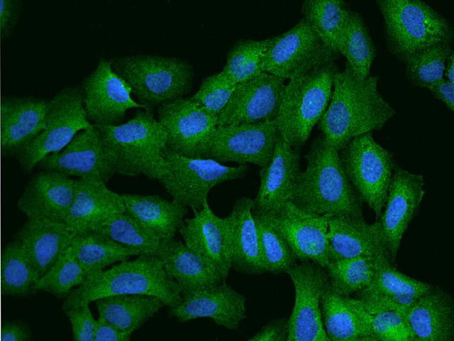 ARHGEF1 Antibody - Immunofluorescence staining of ARHGEF1 in U2OS cells. Cells were fixed with 4% PFA, permeabilzed with 0.1% Triton X-100 in PBS, blocked with 10% serum, and incubated with rabbit anti-Human ARHGEF1 polyclonal antibody (dilution ratio 1:200) at 4°C overnight. Then cells were stained with the Alexa Fluor 488-conjugated Goat Anti-rabbit IgG secondary antibody (green) and counterstained with DAPI (blue). Positive staining was localized to Cytoplasm and cell membrane.
