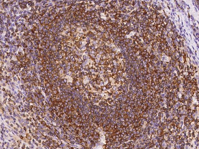 ARHGEF1 Antibody - Immunochemical staining of human ARHGEF1 in human spleen with rabbit polyclonal antibody at 1:2000 dilution, formalin-fixed paraffin embedded sections.