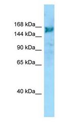 ARHGEF10 / GEF10 Antibody - ARHGEF10 / GEF10 antibody Western Blot of ACHN.  This image was taken for the unconjugated form of this product. Other forms have not been tested.
