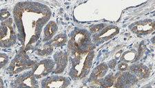 ARHGEF10 / GEF10 Antibody - 1:100 staining human prostate tissue by IHC-P. The sample was formaldehyde fixed and a heat mediated antigen retrieval step in citrate buffer was performed. The sample was then blocked and incubated with the antibody for 1.5 hours at 22°C. An HRP conjugated goat anti-rabbit antibody was used as the secondary.