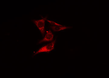 ARHGEF10 / GEF10 Antibody - Staining HeLa cells by IF/ICC. The samples were fixed with PFA and permeabilized in 0.1% Triton X-100, then blocked in 10% serum for 45 min at 25°C. The primary antibody was diluted at 1:200 and incubated with the sample for 1 hour at 37°C. An Alexa Fluor 594 conjugated goat anti-rabbit IgG (H+L) antibody, diluted at 1/600, was used as secondary antibody.