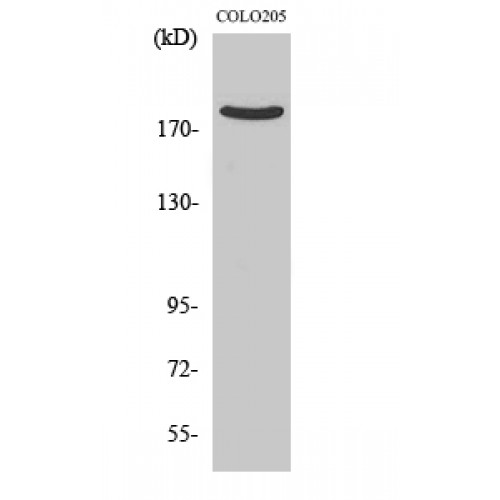 ARHGEF11 Antibody - Western blot of PDZ-RhoGEF antibody