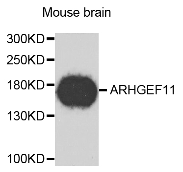 ARHGEF11 Antibody - Western blot analysis of extracts of mouse brain.