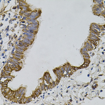 ARHGEF11 Antibody - Immunohistochemistry of paraffin-embedded human lung tissue.