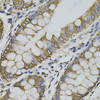ARHGEF11 Antibody - Immunohistochemistry of paraffin-embedded human colon tissue.