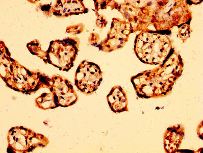 ARHGEF11 Antibody - Immunohistochemistry image at a dilution of 1:500 and staining in paraffin-embedded human placenta tissue performed on a Leica BondTM system. After dewaxing and hydration, antigen retrieval was mediated by high pressure in a citrate buffer (pH 6.0) . Section was blocked with 10% normal goat serum 30min at RT. Then primary antibody (1% BSA) was incubated at 4 °C overnight. The primary is detected by a biotinylated secondary antibody and visualized using an HRP conjugated SP system.