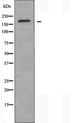 ARHGEF11 Antibody - Western blot analysis of extracts of A549 cells using ARHGEF11 antibody.