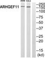 ARHGEF11 Antibody - Western blot analysis of extracts from A549 cells and COLO 205 cells, using ARHGEF11 antibody.