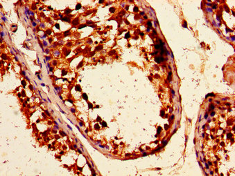 ARHGEF12 Antibody - Immunohistochemistry image of paraffin-embedded human testis tissue at a dilution of 1:100
