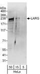 ARHGEF12 Antibody - Detection of Human LARG by Western Blot. Samples: Whole cell lysate (5, 15 and 50 ug) from HeLa cells. Antibodies: Affinity purified rabbit anti-LARG antibody used for WB at 0.4 ug/ml. Detection: Chemiluminescence with an exposure time of 3 minutes.
