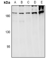 ARHGEF12 Antibody - Western blot analysis of ARHGEF12 expression in A549 (A), LO2 (B), HEK293T (C), CT26 (D), PC12 (E) whole cell lysates.