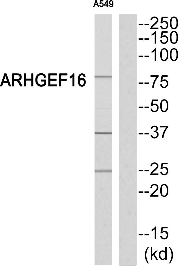 ARHGEF16 Antibody - Western blot analysis of extracts from A549 cells, using ARHGEF16 antibody.