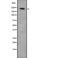 ARHGEF17 / TEM4 Antibody - Western blot analysis of ARHGEF17 using K562 whole cells lysates
