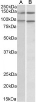 ARHGEF18 Antibody - Goat Anti-P114-RHO-GEF / ARHGEF18 Antibody (0.5µg/ml) staining of lysates of cell lines Daudi (A) and Caco-2 (B) (35µg protein in RIPA buffer). Primary incubation was 1 hour. Detected by chemiluminescencence.