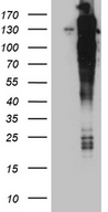 ARHGEF18 Antibody - HEK293T cells were transfected with the pCMV6-ENTRY control. (Left lane) or pCMV6-ENTRY ARHGEF18. (Right lane) cDNA for 48 hrs and lysed