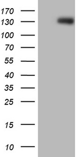 ARHGEF18 Antibody - HEK293T cells were transfected with the pCMV6-ENTRY control. (Left lane) or pCMV6-ENTRY ARHGEF18. (Right lane) cDNA for 48 hrs and lysed. Equivalent amounts of cell lysates. (5 ug per lane) were separated by SDS-PAGE and immunoblotted with anti-ARHGEF18. (1:2000)