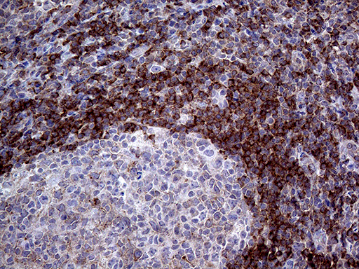ARHGEF18 Antibody - Immunohistochemical staining of paraffin-embedded Human lymph node tissue within the normal limits using anti-ARHGEF18 mouse monoclonal antibody. (Heat-induced epitope retrieval by 1mM EDTA in 10mM Tris buffer. (pH8.5) at 120°C for 3 min. (1:500)