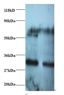 ARHGEF18 Antibody - Western blot of Rho guanine nucleotide exchange factor 18 antibody at 2 ug/ml. Lane 1: EC109whole cell lysate. Lane 2: 293T whole cell lysate. Secondary: Goat polyclonal to Rabbit IgG at 1:15000 dilution. Predicted band size: 129 kDa. Observed band size: 30 kDa Additional bands at: 60 kDa. We are unsure as to the identity of this extra band.  This image was taken for the unconjugated form of this product. Other forms have not been tested.