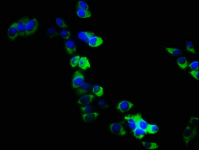 ARHGEF18 Antibody - Immunofluorescence staining of PC3 cells with ARHGEF18 Antibody at 1:133, counter-stained with DAPI. The cells were fixed in 4% formaldehyde, permeabilized using 0.2% Triton X-100 and blocked in 10% normal Goat Serum. The cells were then incubated with the antibody overnight at 4°C. The secondary antibody was Alexa Fluor 488-congugated AffiniPure Goat Anti-Rabbit IgG(H+L).