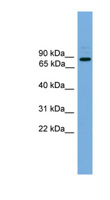 ARHGEF19 / WGEF Antibody - ARHGEF19 antibody Western blot of HeLa lysate. This image was taken for the unconjugated form of this product. Other forms have not been tested.