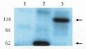ARHGEF2 / GEF-H1 Antibody - Western blot of anti-Lfc antibody on HEK-293 cell transfected with vector alone (1), lfc-short (2) and lfc-long (3).