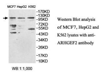 ARHGEF2 / GEF-H1 Antibody - Western blot of ARHGEF2 / GEF-H1 antibody