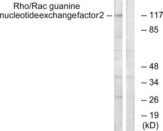 ARHGEF2 / GEF-H1 Antibody - Western blot analysis of lysates from NIH/3T3 cells, using Rho/Rac Guanine Nucleotide Exchange Factor 2 Antibody. The lane on the right is blocked with the synthesized peptide.