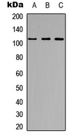 ARHGEF2 / GEF-H1 Antibody - Western blot analysis of GEF H1 expression in HeLa (A); Jurkat (B); NIH3T3 (C) whole cell lysates.