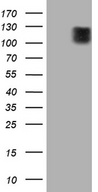 ARHGEF2 / GEF-H1 Antibody - HEK293T cells were transfected with the pCMV6-ENTRY control. (Left lane) or pCMV6-ENTRY ARHGEF2. (Right lane) cDNA for 48 hrs and lysed. Equivalent amounts of cell lysates. (5 ug per lane) were separated by SDS-PAGE and immunoblotted with anti-ARHGEF2. (1:2000)