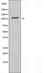 ARHGEF2 / GEF-H1 Antibody - Western blot analysis of extracts of RAW264.7 cells using ARHGEF2 antibody.