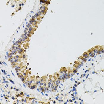 ARHGEF2 / GEF-H1 Antibody - Immunohistochemistry of paraffin-embedded Mouse lung using ARHGEF2 Polyclonal Antibody at dilution of 1:100 (40x lens).
