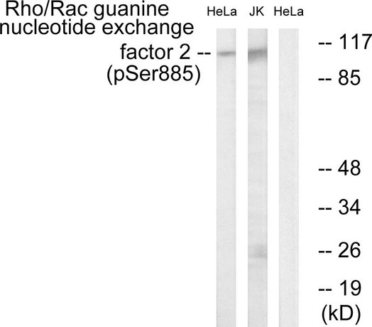 ARHGEF2 / GEF-H1 Antibody - Western blot analysis of lysates from HeLa cells treated with TSA 400nM 24H and Jurkat cells treated with forskolin 40nM 30', using Rho/Rac Guanine Nucleotide Exchange Factor 2 (Phospho-Ser885) Antibody. The lane on the right is blocked with the phospho peptide.