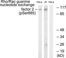 ARHGEF2 / GEF-H1 Antibody - Western blot analysis of lysates from HeLa cells treated with TSA 400nM 24H and Jurkat cells treated with forskolin 40nM 30', using Rho/Rac Guanine Nucleotide Exchange Factor 2 (Phospho-Ser885) Antibody. The lane on the right is blocked with the phospho peptide.