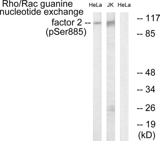 ARHGEF2 / GEF-H1 Antibody - Western blot analysis of extracts from HeLa cells treated with TSA (400nM, 24hours) and Jurkat cells treated with forskolin(40nM, 30mins), using Rho/Rac Guanine Nucleotide Exchange Factor 2 (Phospho-Ser885) antibody.