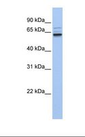 ARHGEF25 / GEFT Antibody - Fetal brain lysate. Antibody concentration: 1.0 ug/ml. Gel concentration: 12%.  This image was taken for the unconjugated form of this product. Other forms have not been tested.