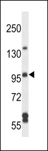 ARHGEF26 / SGEF Antibody - SGEF Antibody western blot of NCI-H460 cell line lysates (35 ug/lane). The SGEF antibody detected the SGEF protein (arrow).
