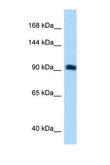 ARHGEF26 / SGEF Antibody - ARHGEF26 / SGEF antibody Western blot of Jurkat Cell lysate. Antibody concentration 1 ug/ml. This image was taken for the unconjugated form of this product. Other forms have not been tested.