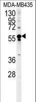 ARHGEF3 / XPLN Antibody - ARHGEF3 Antibody western blot of MDA-MB435 cell line lysates (35 ug/lane). The ARHGEF3 antibody detected the ARHGEF3 protein (arrow).
