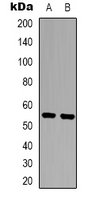 ARHGEF3 / XPLN Antibody - Western blot analysis of XPLN expression in MCF7 (A); COLO205 (B) whole cell lysates.