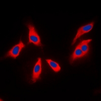 ARHGEF3 / XPLN Antibody - Immunofluorescent analysis of XPLN staining in MCF7 cells. Formalin-fixed cells were permeabilized with 0.1% Triton X-100 in TBS for 5-10 minutes and blocked with 3% BSA-PBS for 30 minutes at room temperature. Cells were probed with the primary antibody in 3% BSA-PBS and incubated overnight at 4 deg C in a humidified chamber. Cells were washed with PBST and incubated with a DyLight 594-conjugated secondary antibody (red) in PBS at room temperature in the dark. DAPI was used to stain the cell nuclei (blue).