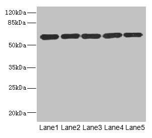ARHGEF3 / XPLN Antibody - Western blot All Lanes: ARHGEF3 antibody at 2.21ug/ml Lane 1: MCF7 whole cell lysate Lane 2: HepG-2 whole cell lysate Lane 3: Jurkat whole cell lysate Lane 4: Hela whole cell lysate Lane 5: 293T whole cell lysate Secondary Goat polyclonal to rabbit IgG at 1/10000 dilution Predicted band size: 60,64,61,37 kDa Observed band size: 60 kDa