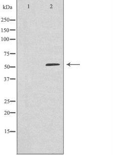 ARHGEF3 / XPLN Antibody - Western blot analysis of extracts of COLO cells using ARHGEF3 antibody. The lane on the left is treated with the antigen-specific peptide.