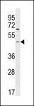 ARHGEF35 Antibody - ARHGEF35 Antibody western blot of T47D cell line lysates (35 ug/lane). The ARHGEF35 antibody detected the ARHGEF35 protein (arrow).