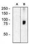ARHGEF4 Antibody - Western blotting analysis of ARHGEF4 in HEK293 cells (A) and HEK293-ARHGEF4 transfectants (B) using mouse monoclonal anti-ARHGEF4 (clone ARHGEF-08).