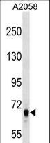 ARHGEF5 Antibody - ARHGEF5 Antibody western blot of A2058 cell line lysates (35 ug/lane). The ARHGEF5 antibody detected the ARHGEF5 protein (arrow).